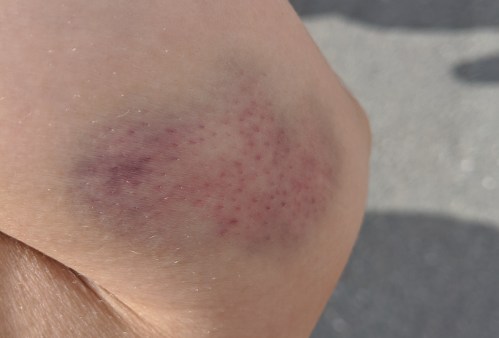 mvimg_20190803_104419